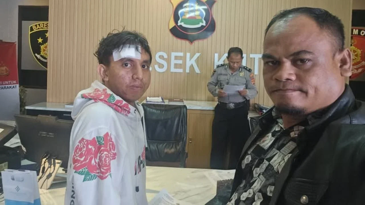 Pemuda Ini Disekap dan Disiksa di Kamar Hotel Bali, Pelaku Lima Orang dan Minta Uang Tebusan Rp100 Juta