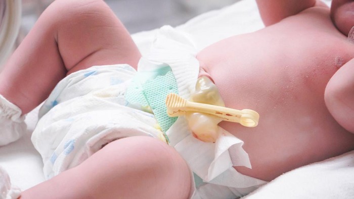 Eks Perawat Nekat Culik Bayi dari RS di Medan, 2 Pelaku Ditangkap
